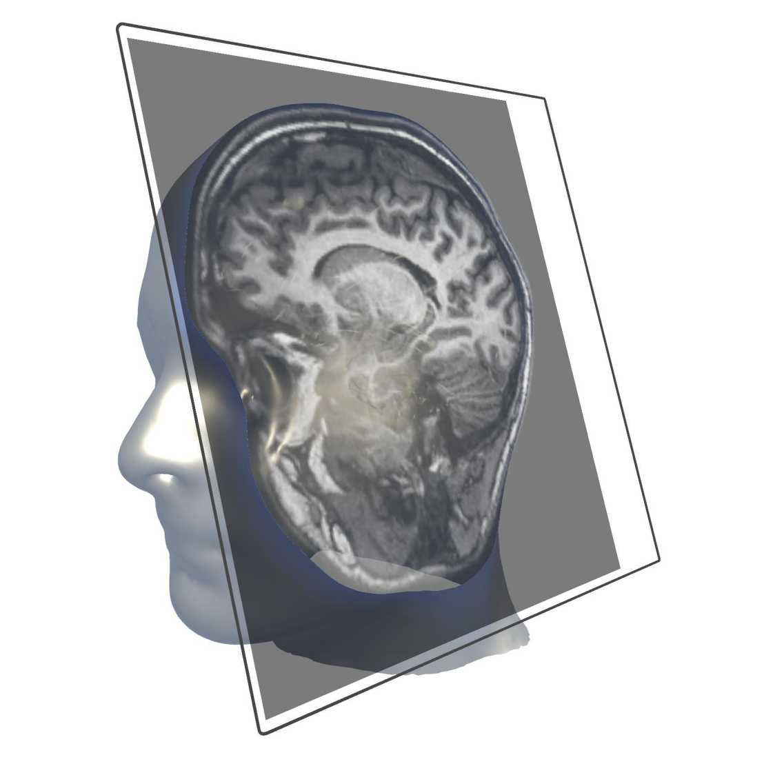 A 3D model of a human head with an intersecting plane displaying an MRI image.