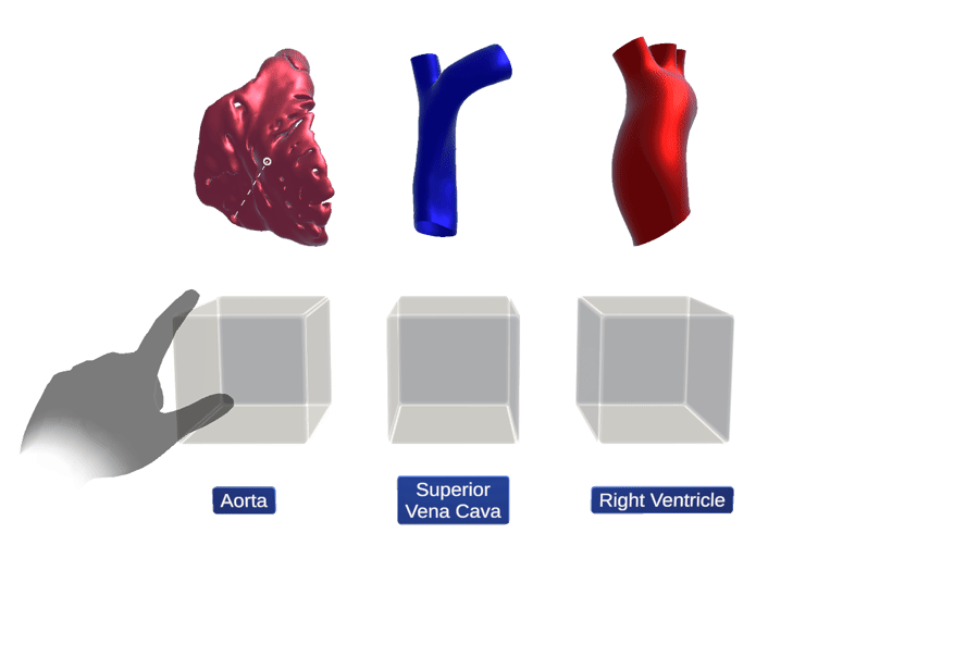 An animation displaying the drag and drop capabilities of Essential Vision. A hand drags a layer of a 3D model of the heart to a labeled box and let's go. The layer snaps to the box.